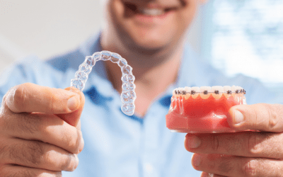 Invisalign vs Braces: Which Orthodontic Treatment is best for me?