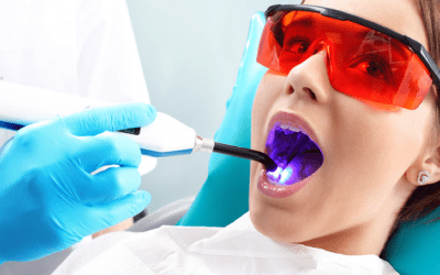 The benefits of using lasers in modern dentistry
